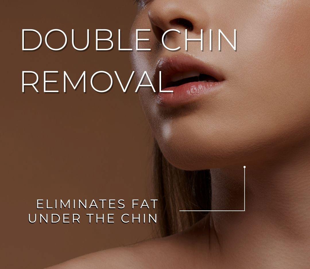 double chin removal toronto