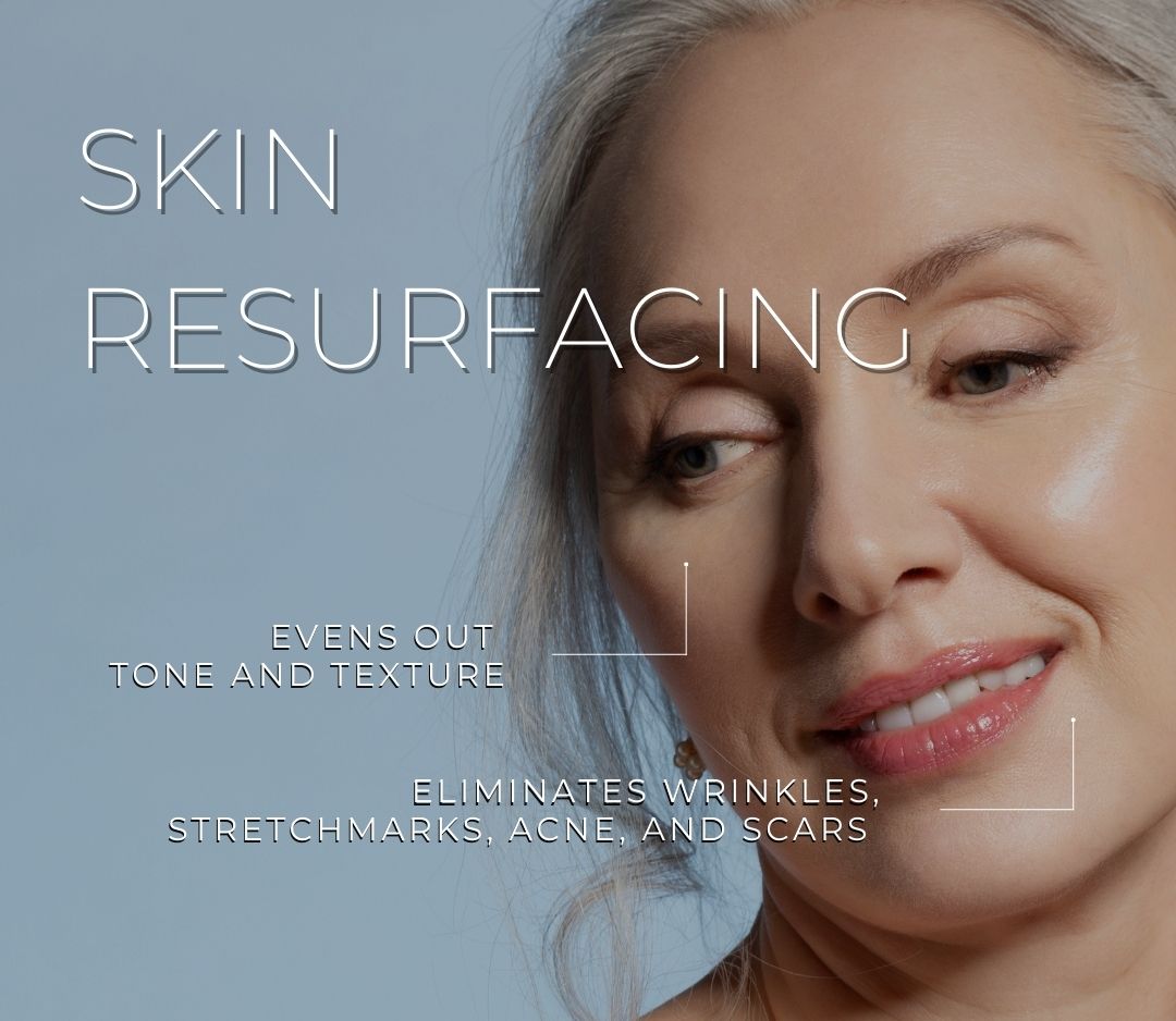 skin resurfacing toronto