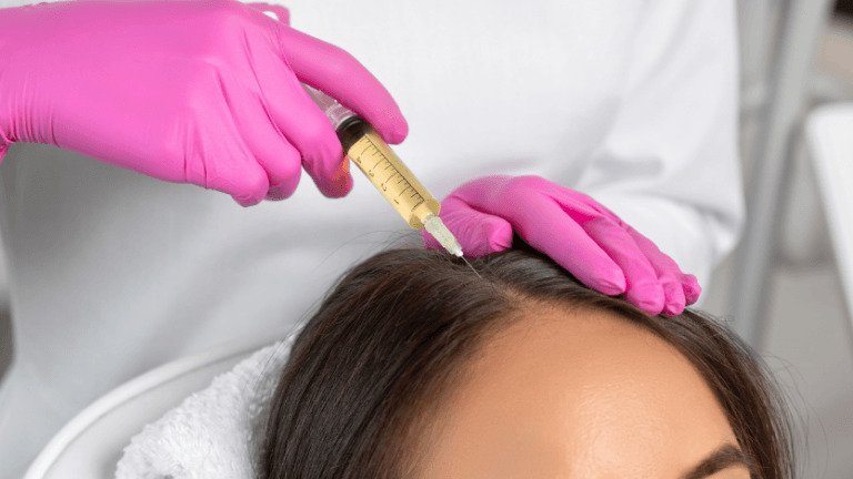 How does PRP treatment help to stop hair loss?