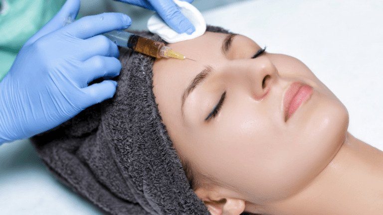All the Benefits of our PRP treatment in Toronto