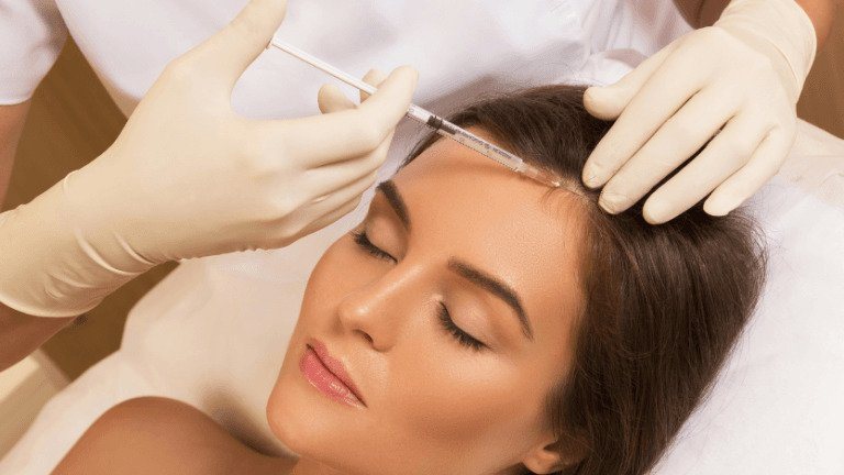 Non-surgical hair restoration with PRP