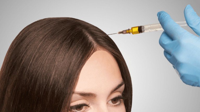 Woman undergoes hair restoration prp injections