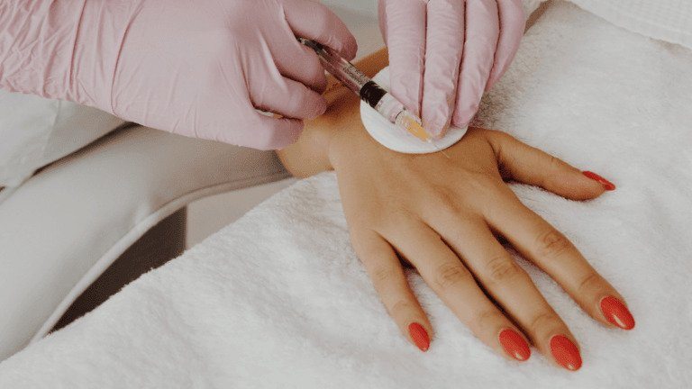 4 things you must know about hand rejuvenation in toronto