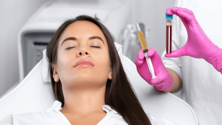 PRP Treatment for Lips