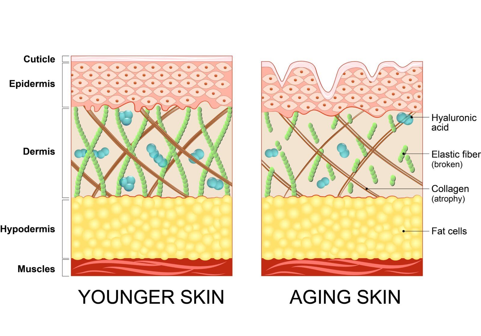 younger skin vs aging skin