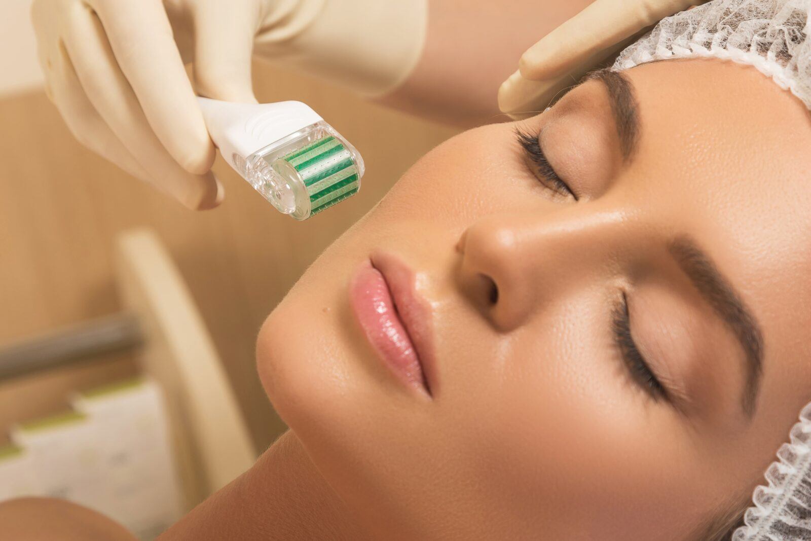 relaxed woman having microneedling performed