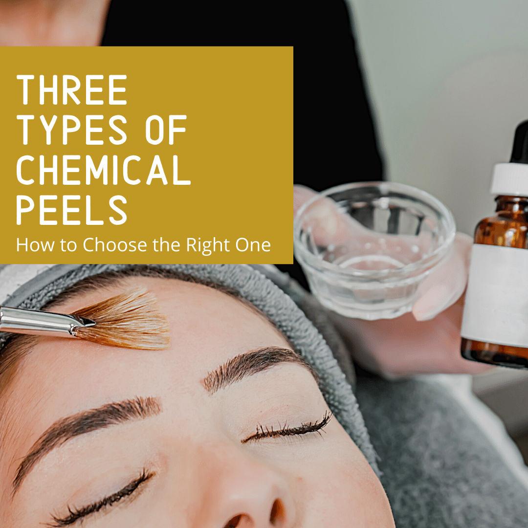 Three Types of Chemical Peels