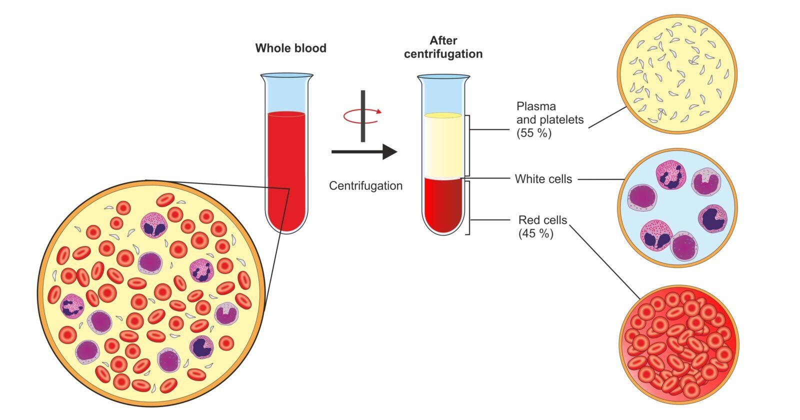 platelet-rich plasma