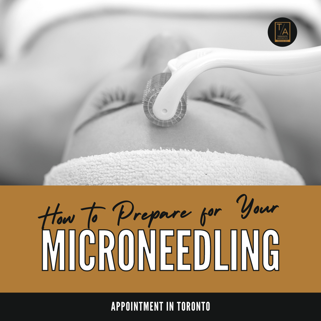 How to Prepare for your microneedling appointment in toronto