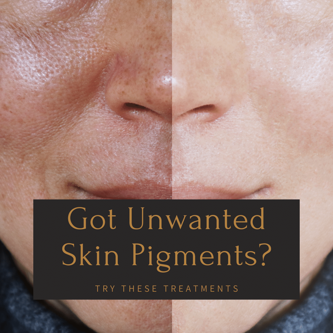 Unwanted Skin Pigments