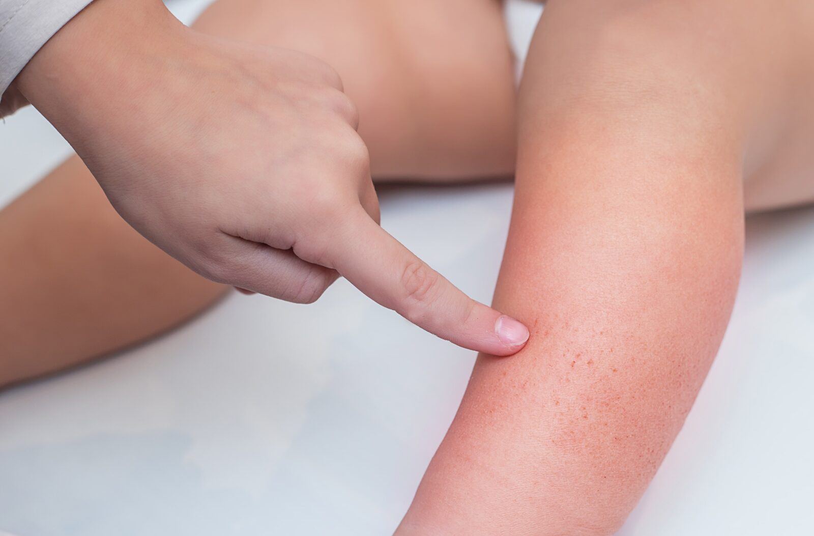 doctor pointing to skin irritation on the leg