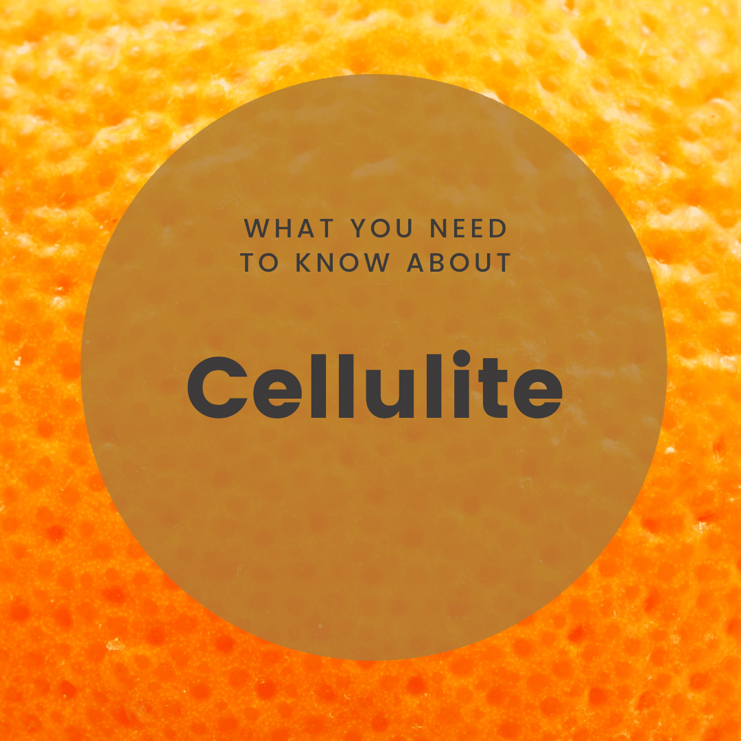 What You Need to Know About cellulite